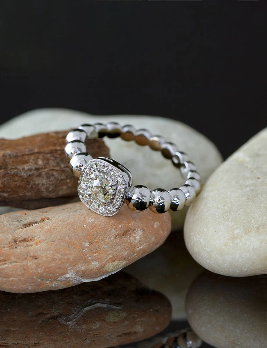 ring omalgami